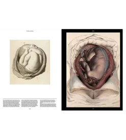 Anatomica, The Exquisite and Unsettling Art of Human Anatomy